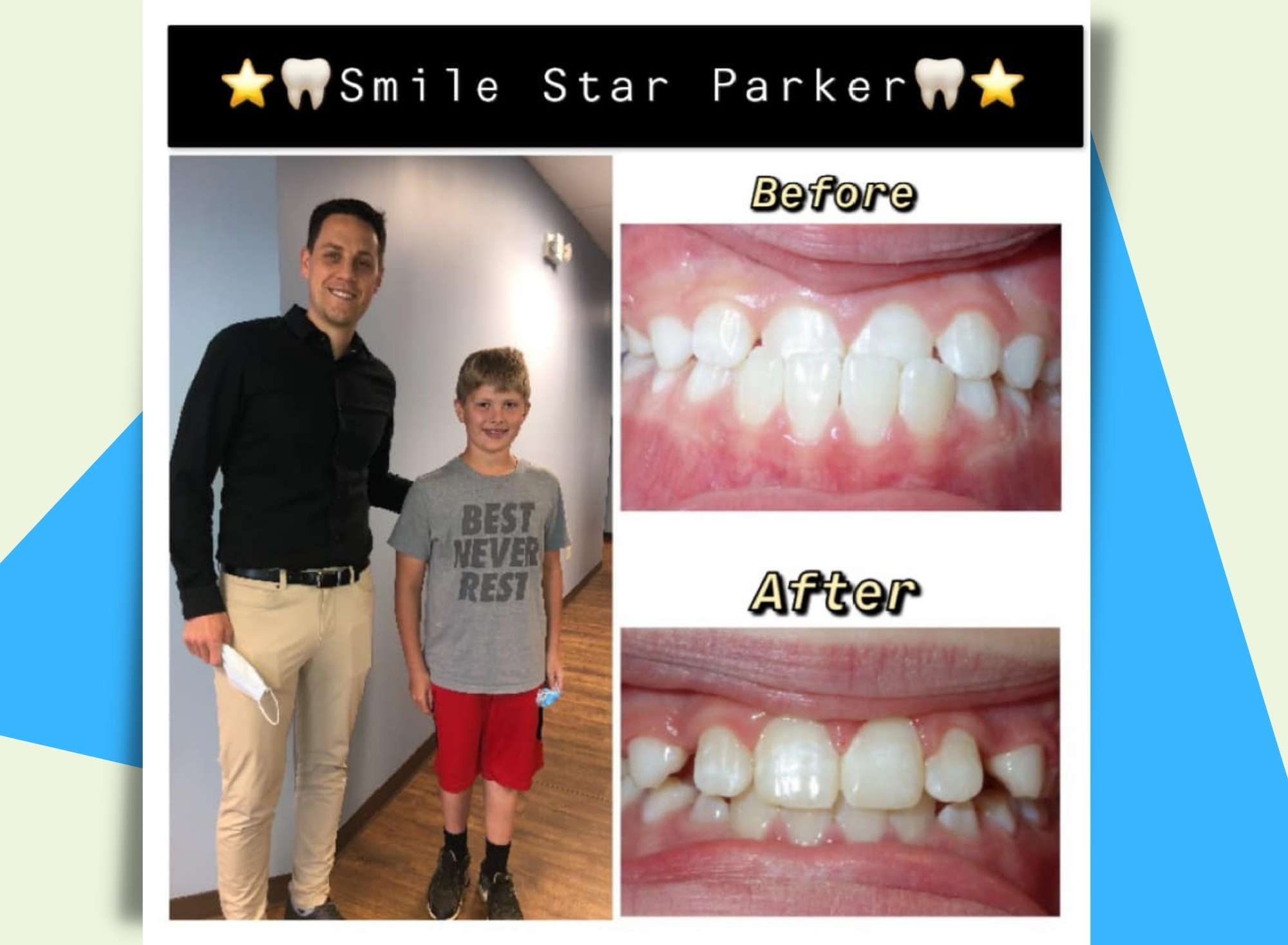 Before and Afters Orthodontic Specialist