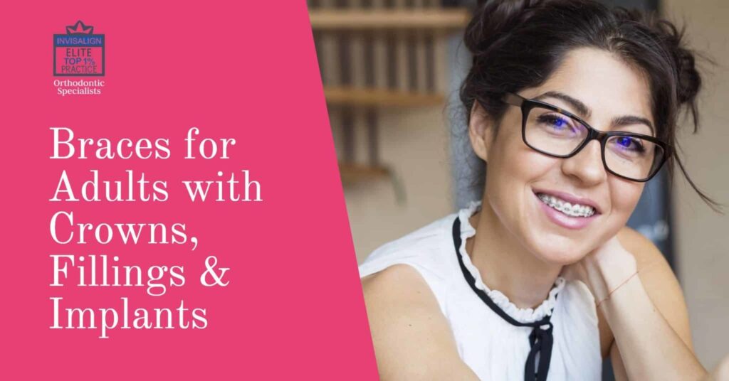 Braces for Adults with Crowns, Fillings & Implants Orthodontic