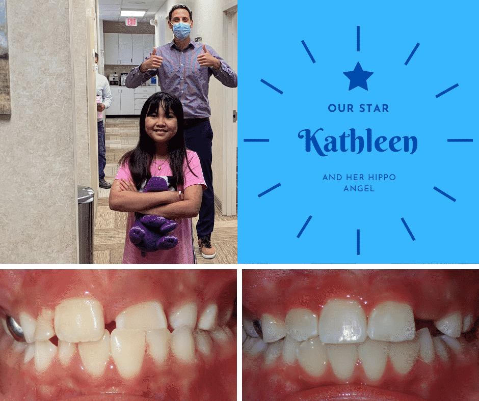 Our Orthodontic Star - Kathleen