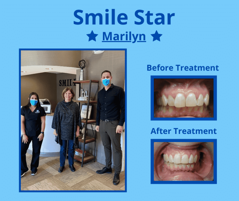 Invisalign No Down Payments Orthodontic Specialists