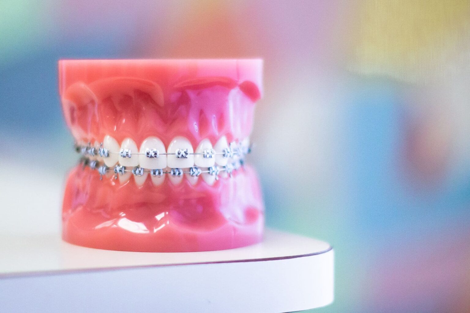 Metal Braces No Down Payments Orthodontic Specialists